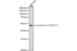 Western blot analysis of extracts of Rat eye, using Cytokeratin 12 (KRT12) (KRT12) antibody (ABIN7268087) at 1:500 dilution. (KRT12 抗体)