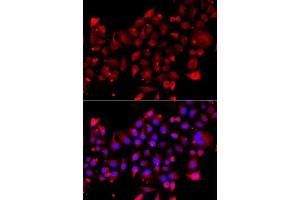 Immunofluorescence analysis of A549 cells using RRM2B antibody (ABIN5974964). (RRM2B 抗体)