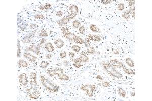 anti-FANCD2/FANCI-Associated Nuclease 1 (FAN1) (AA 1-50) antibody