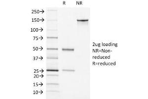 SDS-PAGE (SDS) image for anti-Von Willebrand Factor (VWF) (AA 1815-1939) antibody (ABIN6940895)