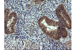 Image no. 3 for anti-Tripartite Motif Containing 44 (TRIM44) antibody (ABIN1501505)