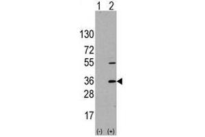 Image no. 1 for anti-Signal Sequence Receptor, alpha (SSR1) (N-Term) antibody (ABIN356936) (SSR1 抗体  (N-Term))