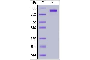 SDS-PAGE (SDS) image for Epidermal Growth Factor Receptor (EGFR) (AA 25-645) (Active) protein (FITC,His tag) (ABIN6933639)