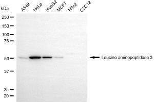 Western blotting analysis using leucine aminopeptidase 3 antibody (ABIN7798268). (Recombinant LAP3 抗体)