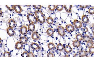 Immunohistochemistry (IHC) image for anti-B-Cell CLL/lymphoma 2 (BCL2) (AA 2-208) antibody (ABIN7432580)