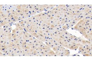 Detection of NUP85 in Human Cardiac Muscle Tissue using Polyclonal Antibody to Nucleoporin 85 (NUP85) (NUP85 抗体  (AA 130-368))