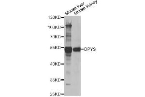 Western blot analysis of extracts of various cell lines, using DPYS antibody (ABIN5973775) at 1/1000 dilution. (DPYS 抗体)