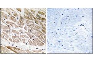 Immunohistochemistry analysis of paraffin-embedded human heart tissue, using RHG1 Antibody. (RHG1 (AA 189-238) 抗体)