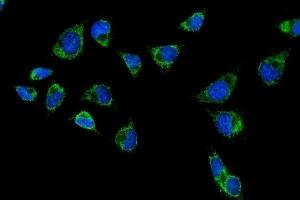 IF analysis of CPS1 using anti-CPS1 antibody (ABIN7599871).