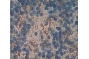 Used in DAB staining on fromalin fixed paraffin- embedded Kidney tissue (EMR2 抗体  (AA 347-509))