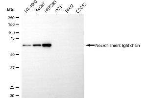Western blotting analysis using neurofilament light chain antibody (ABIN7799582). (NEFL 抗体)