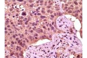 Immunohistochemistry (IHC) image for anti-Glycogen Synthase Kinase 3 alpha (GSK3a) (truncated) antibody (ABIN2464059) (GSK3 alpha 抗体  (truncated))
