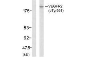 Western blot analysis of extracts from SK-OV3 cells, using VEGFR2 (Phospho-Tyr951) Antibody. (VEGFR2/CD309 抗体  (pTyr951))