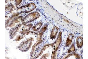 Immunohistochemistry (IHC) image for anti-Ets Variant 6 (ETV6) (AA 327-448) antibody (ABIN5693220)