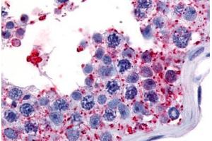 Human Testis (formalin-fixed, paraffin-embedded) stained with WNK1 antibody ABIN213556 at 7 ug/ml followed by biotinylated goat anti-rabbit IgG secondary antibody ABIN481713, alkaline phosphatase-streptavidin and chromogen. (WNK1 抗体  (Internal Region))