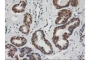 Image no. 10 for anti-Excision Repair Cross-Complementing Rodent Repair Deficiency, Complementation Group 4 (ERCC4) antibody (ABIN1498070)
