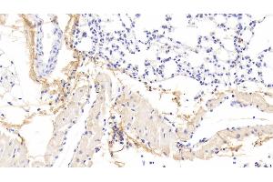 Detection of OGN in Mouse Lung Tissue using Polyclonal Antibody to Osteoglycin (OGN) (OGN 抗体  (AA 180-298))