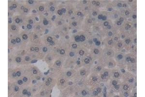 Immunohistochemistry (IHC) image for anti-Glutathione S-Transferase theta 1 (GSTT1) (AA 7-240) antibody (ABIN7432226)