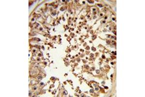 Formalin-fixed and paraffin-embedded human testis tissue reacted with DMC1 antibody (N-term) followed followed by peroxidase-conjugated secondary antibody and DAB staining. (DMC1 抗体  (N-Term))