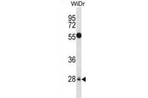 Western Blotting (WB) image for anti-Mediator Complex Subunit 6 (MED6) antibody (ABIN2998132) (MED6 抗体)