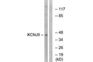 Western blot analysis of extracts from LOVO cells, using KCNJ9 Antibody. (KCNJ9 抗体  (AA 61-110))