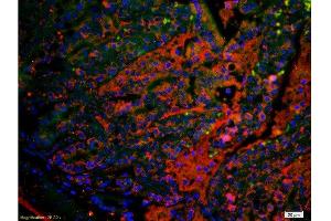 Formalin-fixed and paraffin embedded mouse small intestine labeled with Anti TSPAN20/UPIb Polyclonal Antibody, PE conjugated -PE) 1:200, 60 minutes at 37°C. (Uroplakin 1B 抗体  (AA 150-197))