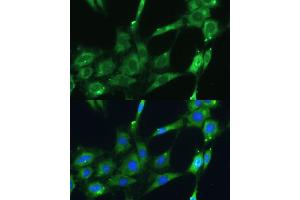 Immunofluorescence analysis of C6 cells using SPARC Polyclonal Antibody (ABIN7270183) at dilution of 1:100 (40x lens). (SPARC 抗体  (AA 18-303))