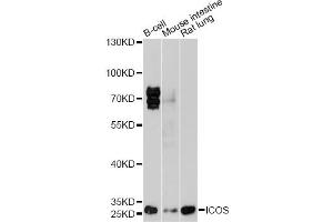 Western blot analysis of extracts of various cell lines, using ICOS antibody (ABIN1873127) at 1:1000 dilution. (ICOS 抗体)