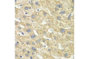 Immunohistochemistry of paraffin-embedded human liver injury using DLD antibody. (DLD 抗体  (AA 36-300))