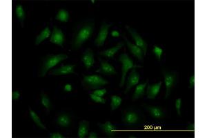 Immunofluorescence of monoclonal antibody to TCF19 on HeLa cell. (TCF19 抗体  (AA 17-102))