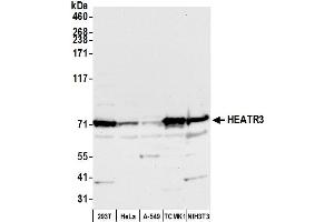 anti-HEAT Repeat Containing 3 (HEATR3) (AA 25-75) antibody