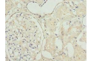 Immunohistochemistry of paraffin-embedded human kidney tissue using ABIN7172851 at dilution of 1:100 (TAGLN2 抗体  (AA 1-199))