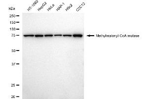 Western blotting analysis using Methylmalonyl-CoA mutase antibody (ABIN7799396). (Recombinant MUT 抗体)