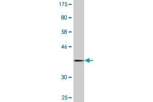 Western Blot detection against Immunogen (37. (Prolactin Receptor 抗体  (AA 371-479))