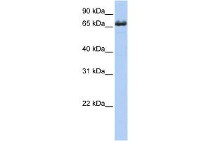 WB Suggested Anti-ZDHHC17 Antibody Titration:  0. (ZDHHC17 抗体  (Middle Region))