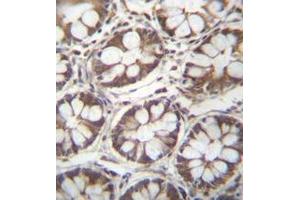 Immunohistochemistry analysis in human rectum tissue (formalin-fixed, paraffin-embedded) using Ladinin-1  Antibody (N-term), followed by peroxidase conjugation of the secondary antibody and DAB staining. (Ladinin 1 抗体  (N-Term))