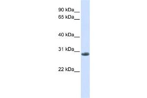Western Blotting (WB) image for anti-Yip1 Domain Family, Member 6 (YIPF6) antibody (ABIN2458683) (YIPF6 抗体)