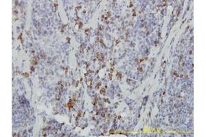 Image no. 1 for anti-Ankyrin Repeat and SOCS Box Containing 9 (ASB9) (AA 1-253) antibody (ABIN466270) (ASB9 抗体  (AA 1-253))