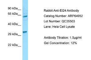 Western Blotting (WB) image for anti-Etoposide Induced 2.4 (EI24) (N-Term) antibody (ABIN970601) (EI24 抗体  (N-Term))