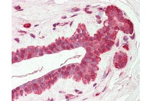 Human Breast: Formalin-Fixed, Paraffin-Embedded (FFPE) (AMIGO2 抗体  (C-Term))