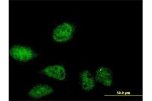 Immunofluorescence of purified MaxPab antibody to SERTAD2 on HeLa cell. (SERTAD2 抗体  (AA 1-314))