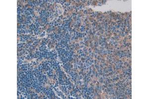 Used in DAB staining on fromalin fixed paraffin- embedded spleen tissue (CFP 抗体  (AA 65-190))