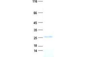 Folate Receptor 4 (Delta) (FOLR4) protein (His tag)