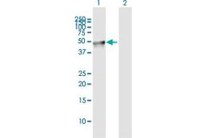 Western Blot analysis of LEPRE1 expression in transfected 293T cell line by LEPRE1 MaxPab polyclonal antibody. (LEPRE1 抗体  (AA 1-390))