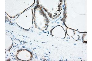 Immunohistochemical staining of paraffin-embedded Human Kidney tissue using anti-KHK mouse monoclonal antibody. (Ketohexokinase 抗体)