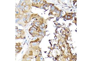 Immunohistochemistry (IHC) image for anti-NLR Family, Pyrin Domain Containing 1 (NLRP1) (AA 1000-1100) antibody (ABIN7268935)