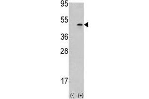 Western Blotting (WB) image for anti-Aurora Kinase B (AURKB) (AA 283-313) antibody (ABIN3030077)
