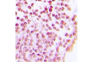 Immunohistochemistry (IHC) image for anti-Sirtuin 1 (SIRT1) antibody (ABIN7308334) (SIRT1 抗体)