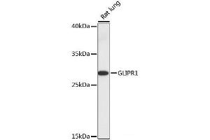 Western blot analysis of extracts of Rat lung using GLIPR1 Polyclonal Antibody at dilution of 1:1000. (GLIPR1 抗体)