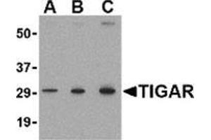 Western blot analysis of TIGAR in MCF7 cell lysate with this product at (A) 0. (TIGAR 抗体  (Center))